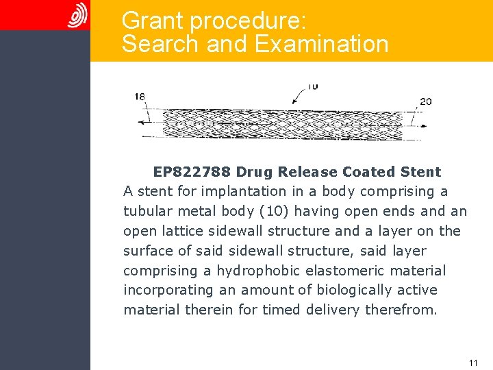 Grant procedure: Search and Examination EP 822788 Drug Release Coated Stent A stent for