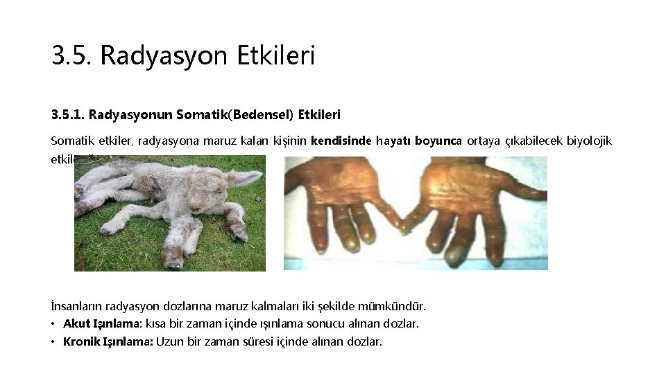 3. 5. Radyasyon Etkileri 3. 5. 1. Radyasyonun Somatik(Bedensel) Etkileri Somatik etkiler, radyasyona maruz