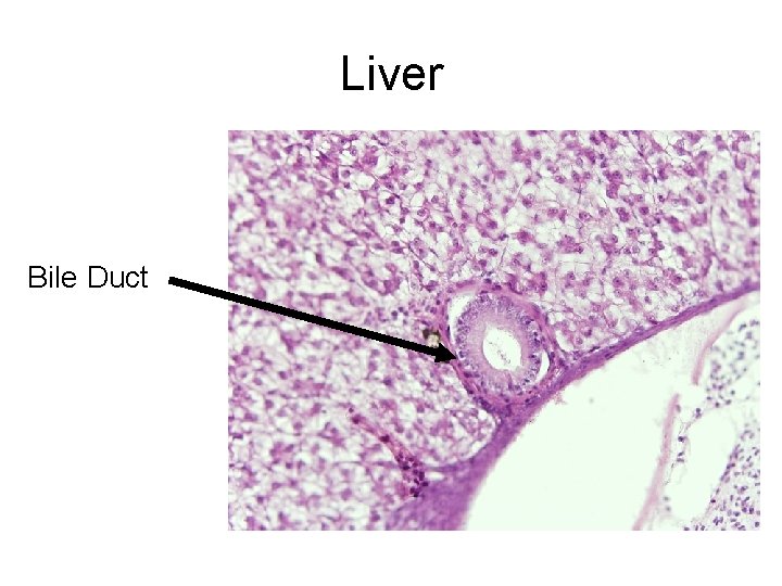 Liver Bile Duct 