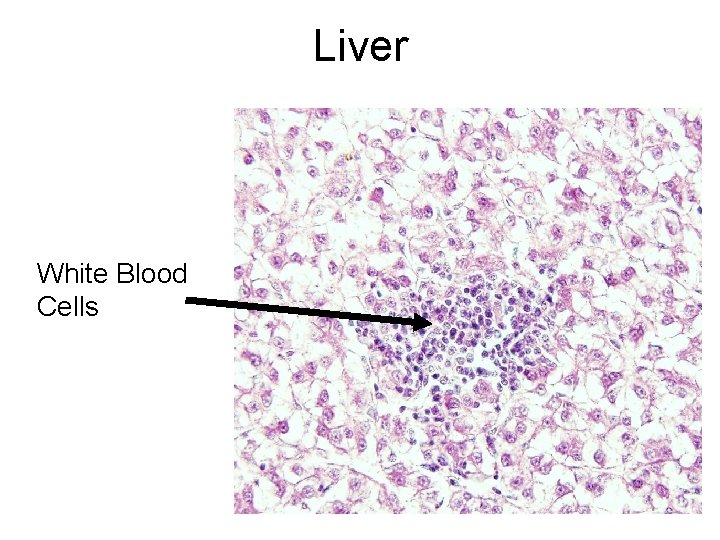 Liver White Blood Cells 