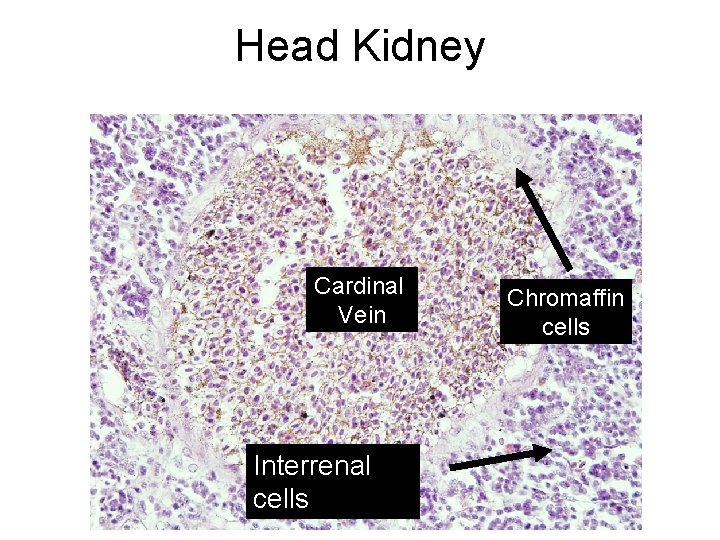 Head Kidney Cardinal Vein Interrenal cells Chromaffin cells 