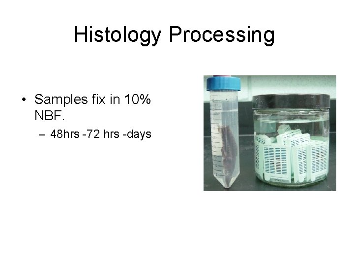 Histology Processing • Samples fix in 10% NBF. – 48 hrs -72 hrs -days