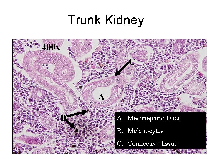 Trunk Kidney 400 x C A B A. Mesonephric Duct B. Melanocytes C. Connective