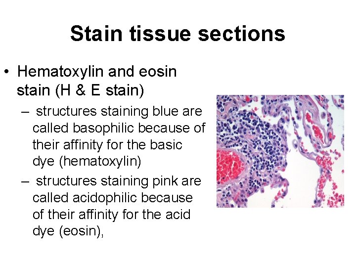 Stain tissue sections • Hematoxylin and eosin stain (H & E stain) – structures