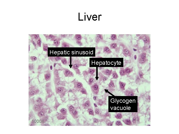 Liver Hepatic sinusoid Hepatocyte Glycogen vacuole 1000 X 