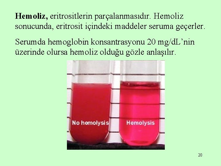 Hemoliz, eritrositlerin parçalanmasıdır. Hemoliz sonucunda, eritrosit içindeki maddeler seruma geçerler. Serumda hemoglobin konsantrasyonu 20