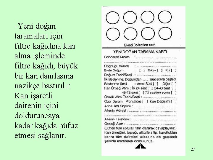 -Yeni doğan taramaları için filtre kağıdına kan alma işleminde filtre kağıdı, büyük bir kan