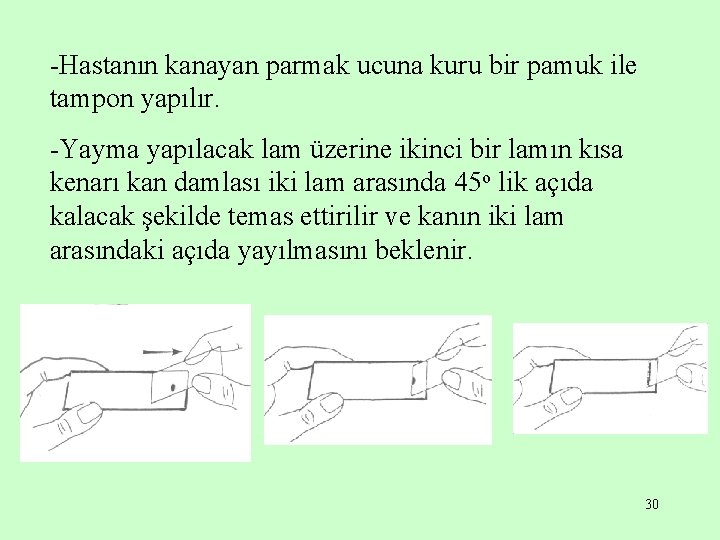 -Hastanın kanayan parmak ucuna kuru bir pamuk ile tampon yapılır. -Yayma yapılacak lam üzerine