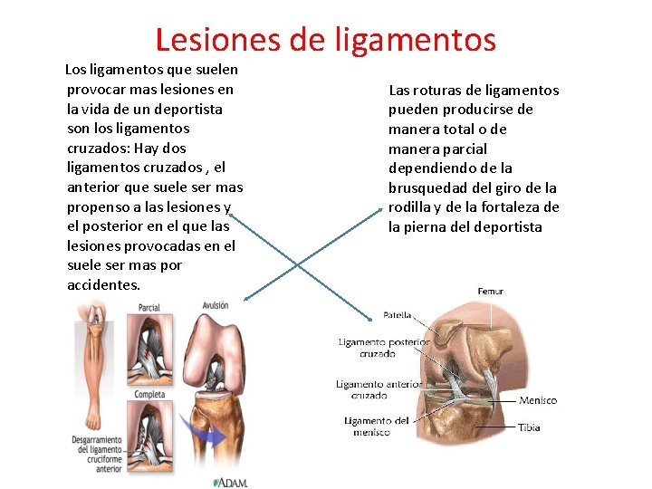 Lesiones de ligamentos Los ligamentos que suelen provocar mas lesiones en la vida de Lesiones de ligamentos Los ligamentos que suelen provocar mas lesiones en la vida de