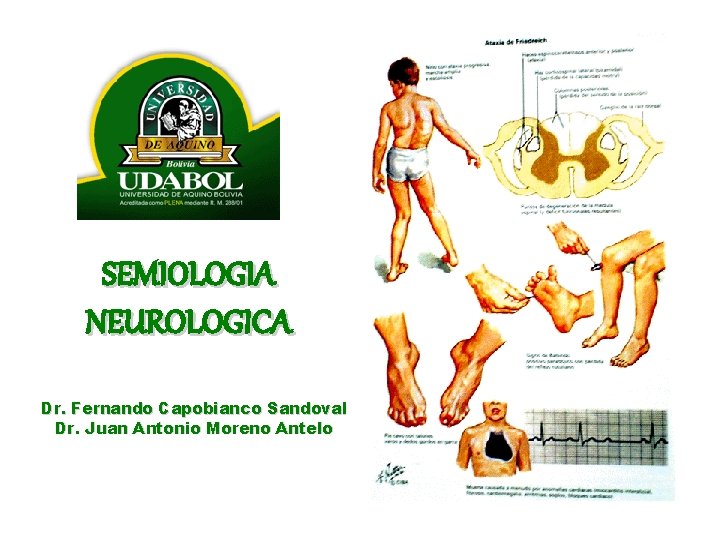 SEMIOLOGIA NEUROLOGICA Dr. Fernando Capobianco Sandoval Dr. Juan Antonio Moreno Antelo 