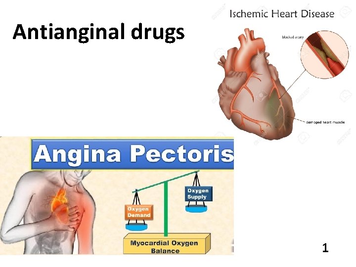 Antianginal drugs 1 