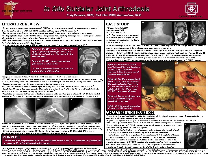 In Situ Subtalar Joint Arthrodesis THE PODIATRY INSTITUTE Craig Camasta, DPM; Carl Kihm DPM;