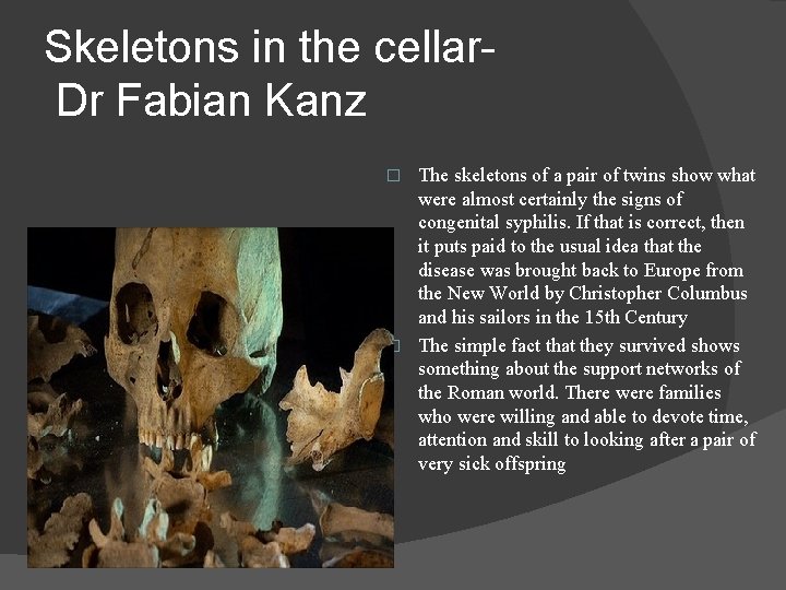 Skeletons in the cellar. Dr Fabian Kanz The skeletons of a pair of twins