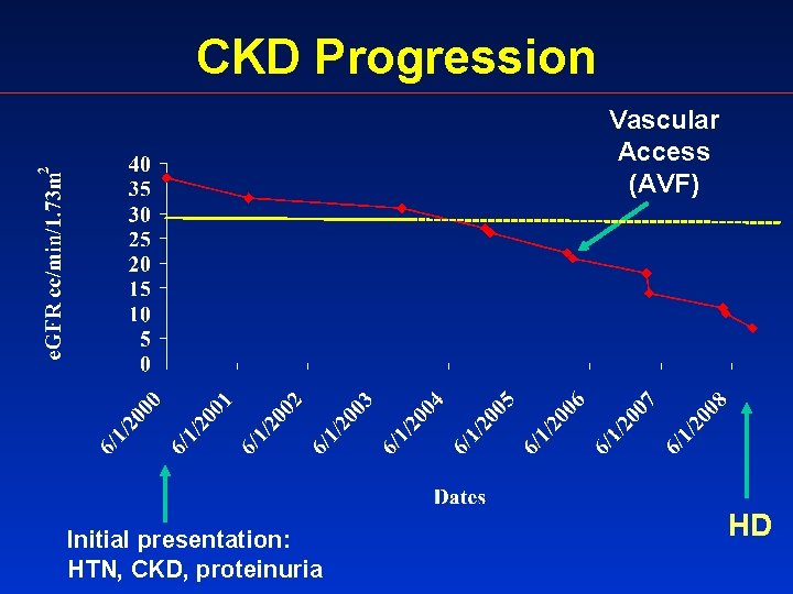 CKD Progression Vascular Access (AVF) Initial presentation: HTN, CKD, proteinuria HD 