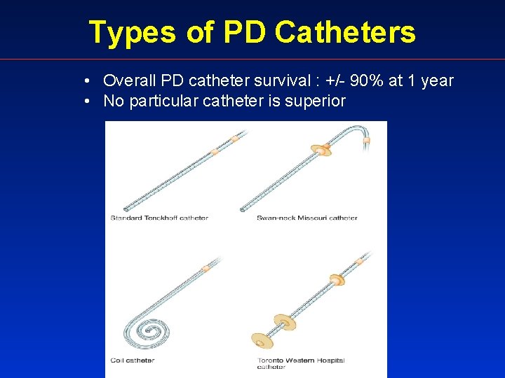 Types of PD Catheters • Overall PD catheter survival : +/- 90% at 1