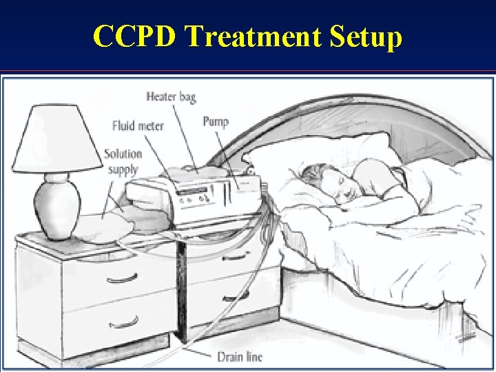CCPD Treatment Setup 