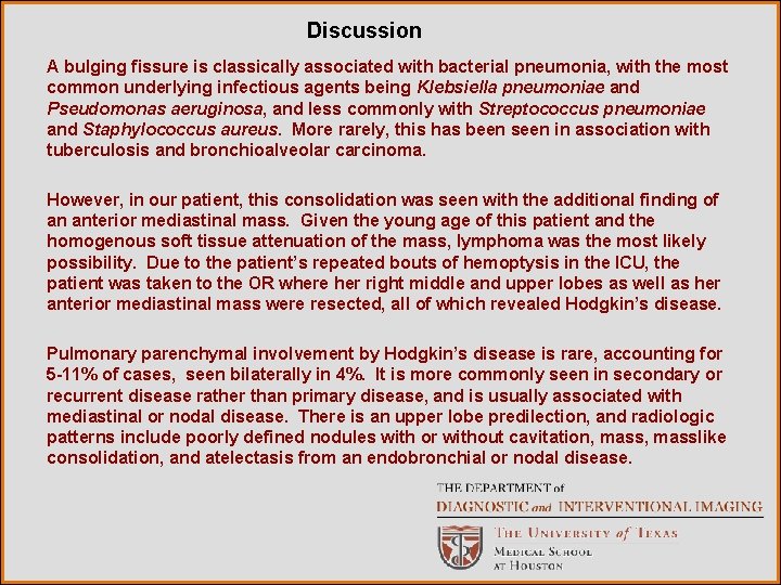 Discussion A bulging fissure is classically associated with bacterial pneumonia, with the most common