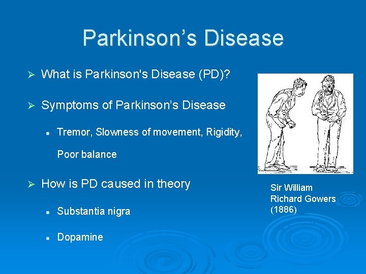 Parkinson’s Disease What is Parkinson's Disease (PD)? Symptoms of Parkinson’s Disease Tremor, Slowness of