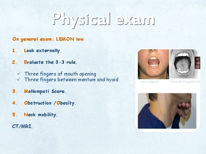 Physical exam On general exam: LEMON law 1. Look externally. 2. Evaluate the 3 Physical exam On general exam: LEMON law 1. Look externally. 2. Evaluate the 3