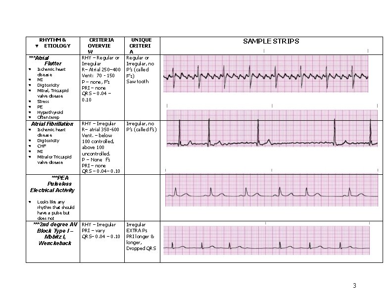 CRITERIA OVERVIE W RHY – Regular or Irregular R– Atrial 250– 400 Vent: 70