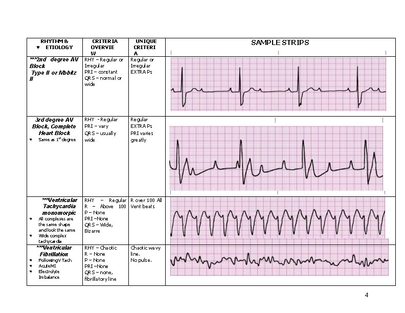 ♥ RHYTHM & ETIOLOGY ***2 nd degree AV Block Type II or Mobitz II