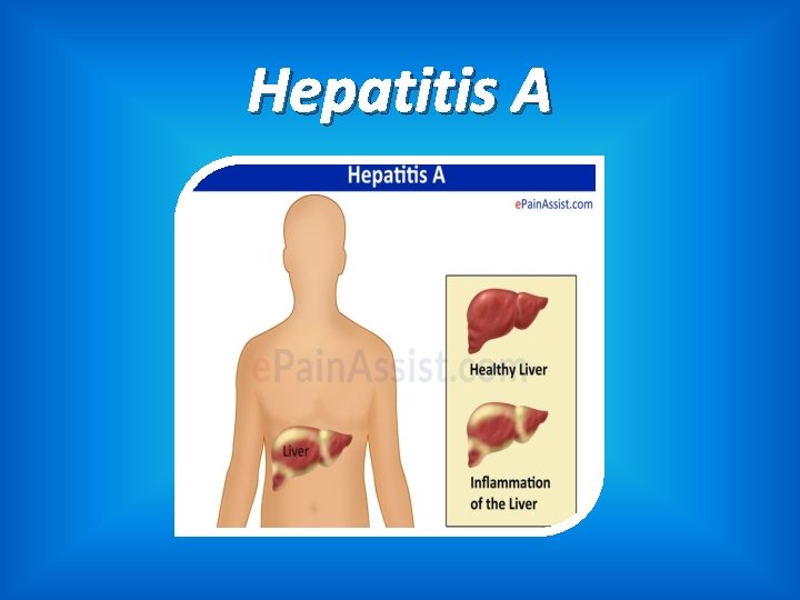 Hepatitis A 