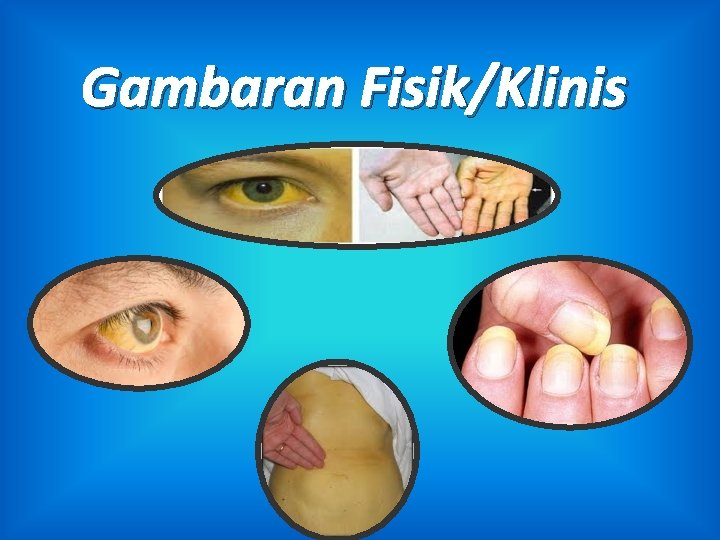 Gambaran Fisik/Klinis 