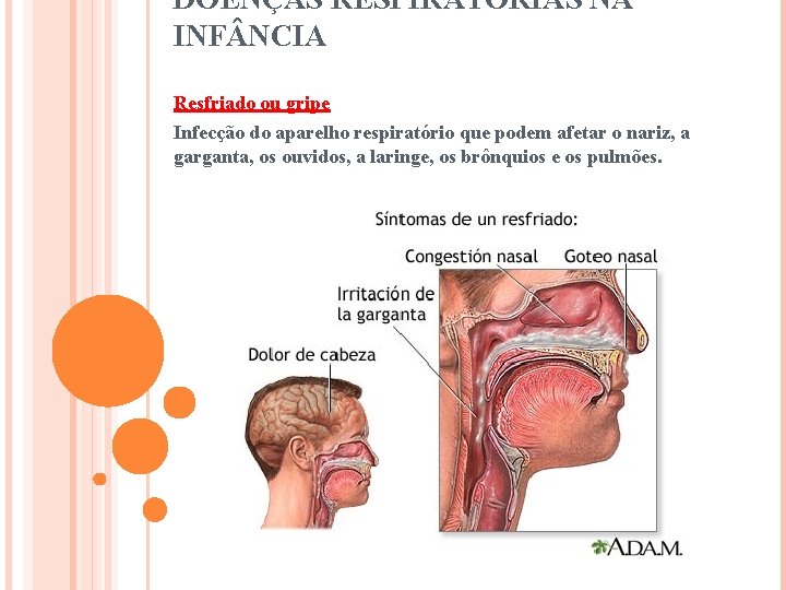 DOENÇAS RESPIRATÓRIAS NA INF NCIA Resfriado ou gripe Infecção do aparelho respiratório que podem