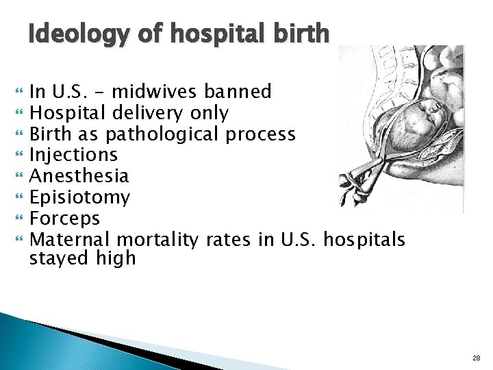 Ideology of hospital birth In U. S. - midwives banned Hospital delivery only Birth