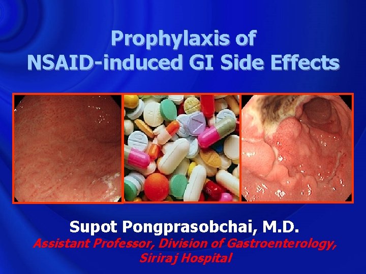 Prophylaxis of NSAID-induced GI Side Effects Supot Pongprasobchai, M. D. Assistant Professor, Division of