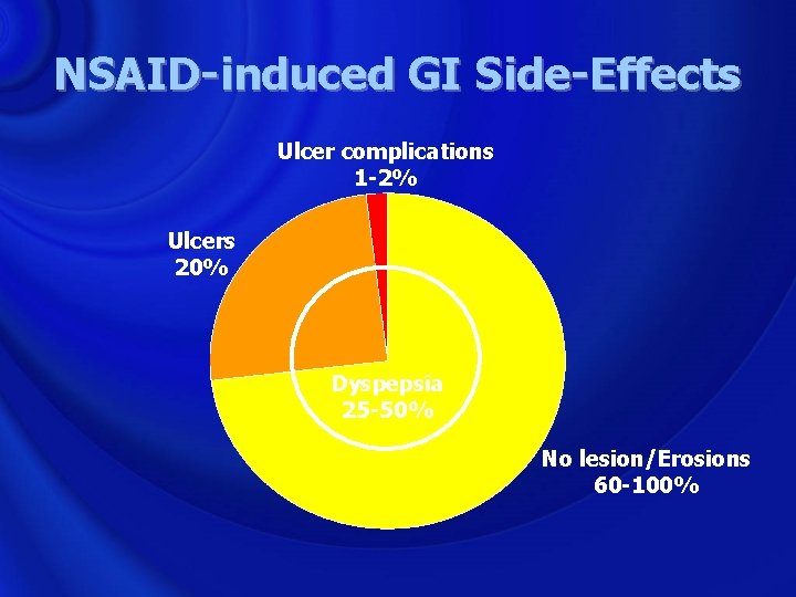 NSAID-induced GI Side-Effects Ulcer complications 1 -2% Ulcers 20% Dyspepsia 25 -50% No lesion/Erosions