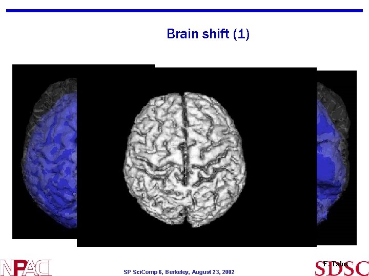 Brain shift (1) F. Talos SP Sci. Comp 6, Berkeley, August 23, 2002 Brain shift (1) F. Talos SP Sci. Comp 6, Berkeley, August 23, 2002