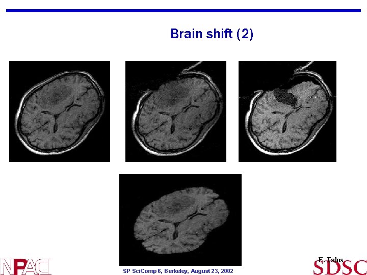 Brain shift (2) F. Talos SP Sci. Comp 6, Berkeley, August 23, 2002 Brain shift (2) F. Talos SP Sci. Comp 6, Berkeley, August 23, 2002