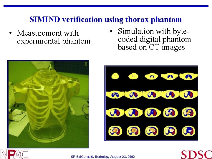 SIMIND verification using thorax phantom • Simulation with byte • Measurement with coded digital SIMIND verification using thorax phantom • Simulation with byte • Measurement with coded digital