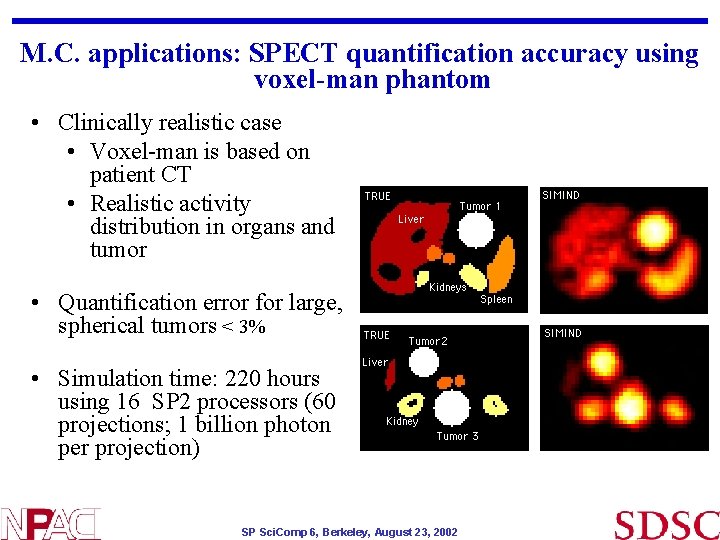 M. C. applications: SPECT quantification accuracy using voxel-man phantom • Clinically realistic case • M. C. applications: SPECT quantification accuracy using voxel-man phantom • Clinically realistic case •