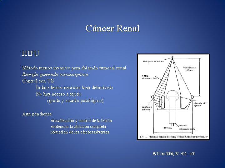 Cáncer Renal HIFU Método menos invasivo para ablación tumoral renal Energía generada extracorpórea Control