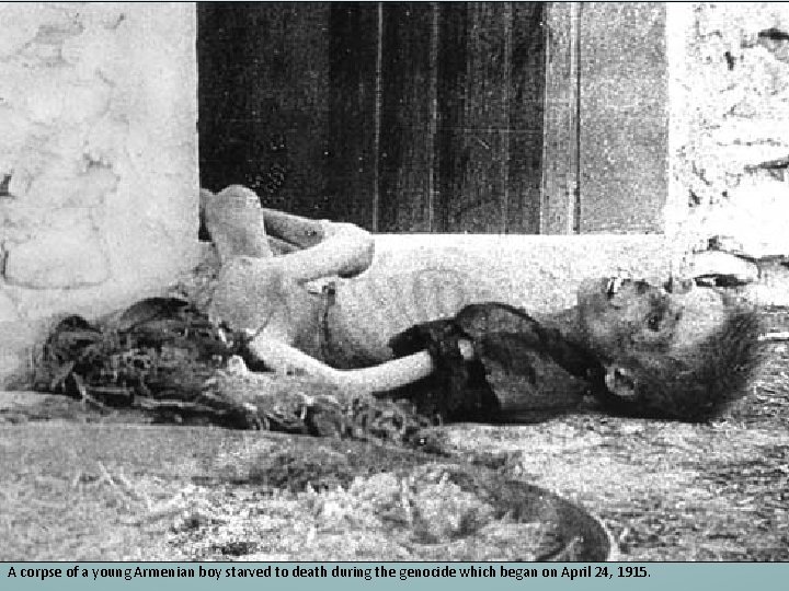 A corpse of a young Armenian boy starved to death during the genocide which