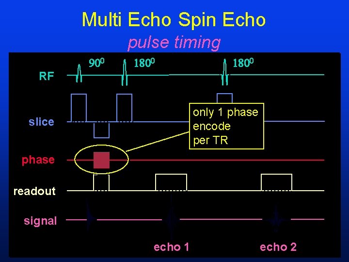 Multi Echo Spin Echo pulse timing RF only 1 phase encode per TR slice