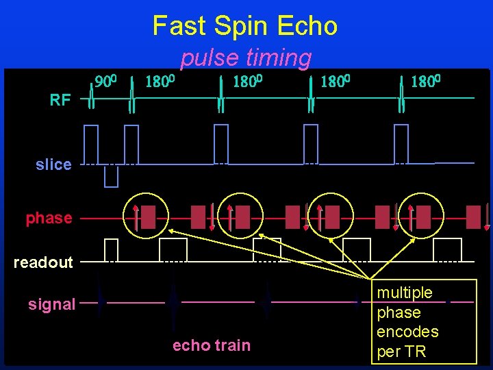 Fast Spin Echo pulse timing RF slice phase readout signal echo train multiple phase