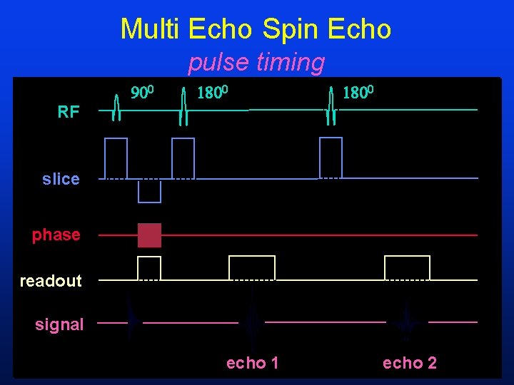 Multi Echo Spin Echo pulse timing RF slice phase readout signal echo 1 echo