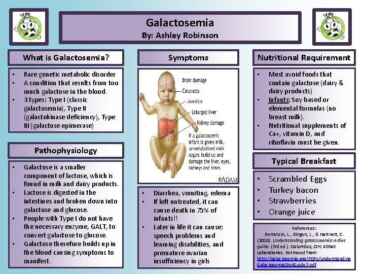 Galactosemia By: Ashley Robinson What is Galactosemia? • • • Symptoms Rare genetic metabolic