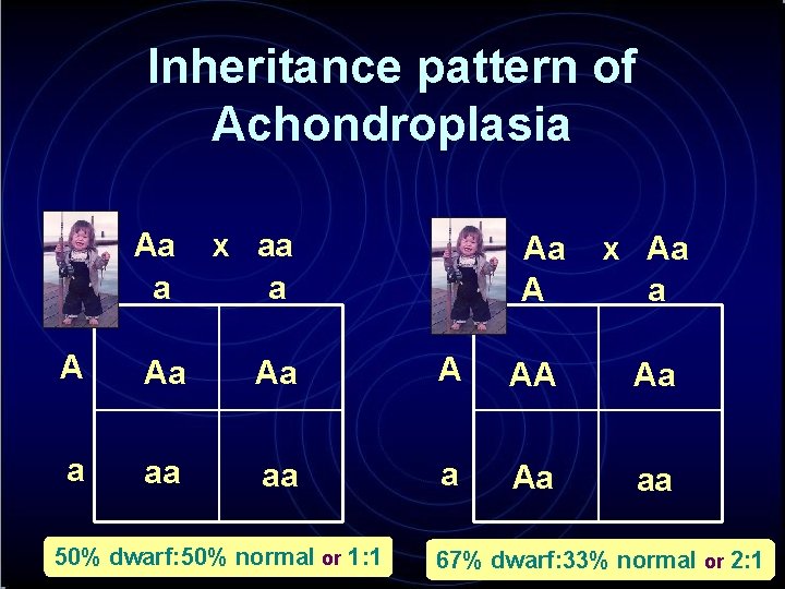 Inheritance pattern of Achondroplasia Aa a x aa a Aa A x Aa a