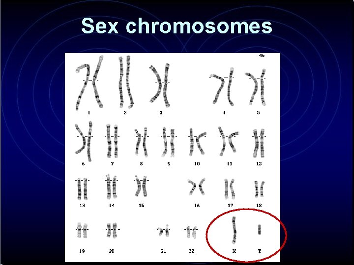 Sex chromosomes 