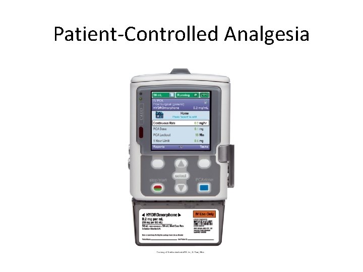 Patient-Controlled Analgesia 