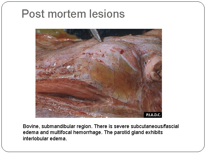 Post mortem lesions Bovine, submandibular region. There is severe subcutaneous/fascial edema and multifocal hemorrhage.