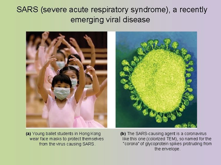 SARS (severe acute respiratory syndrome), a recently emerging viral disease (a) Young ballet SARS (severe acute respiratory syndrome), a recently emerging viral disease (a) Young ballet