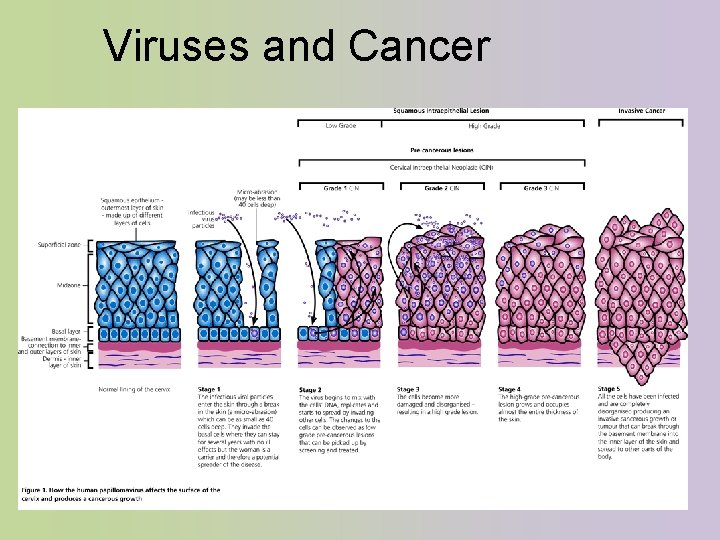 Viruses and Cancer 