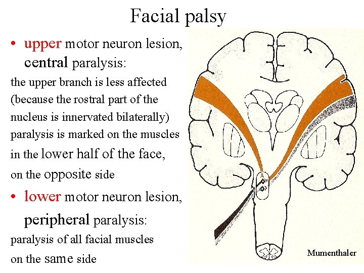 Facial palsy • upper motor neuron lesion, central paralysis: the upper branch is less Facial palsy • upper motor neuron lesion, central paralysis: the upper branch is less