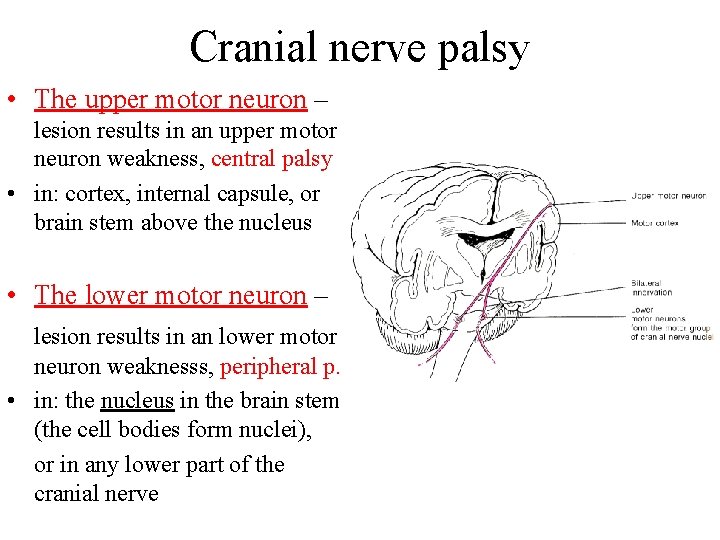Cranial nerve palsy • The upper motor neuron – lesion results in an upper Cranial nerve palsy • The upper motor neuron – lesion results in an upper