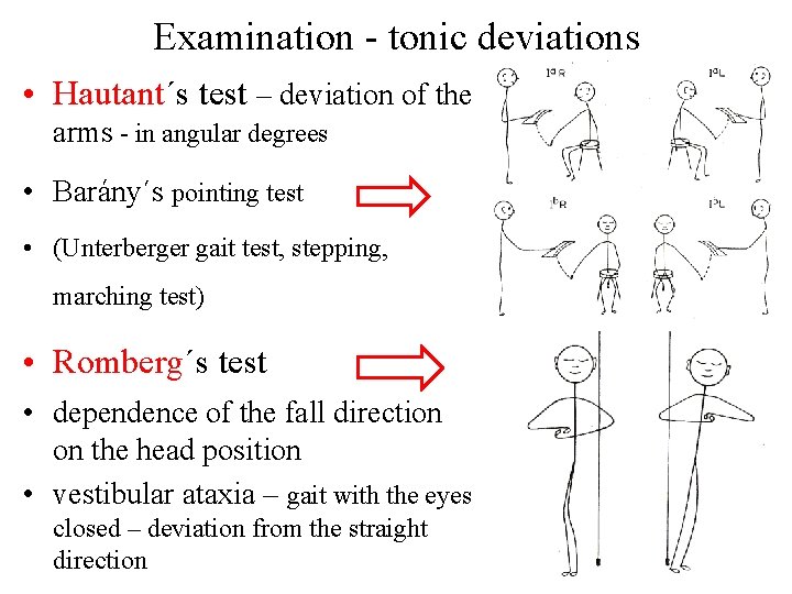 Examination - tonic deviations • Hautant´s test – deviation of the arms - in Examination - tonic deviations • Hautant´s test – deviation of the arms - in